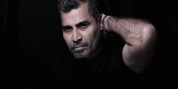 Salman Khan Hair Transplant; Film Producer Shailendra Singh