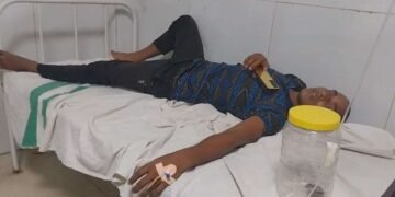 सांप ने काटा तो युवक ने किया कुछ ऐसा जो मच गया हड़कंप, डॉक्टर्स भी रह गए हैरान
