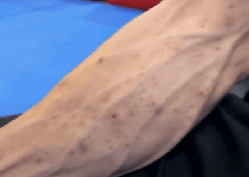 Tiger Shroff Injury Video | Juhu Firing Incident Update