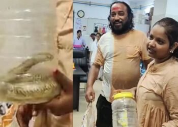 सांप ने काटा तो जिंदा कोबरा लेकर अस्पताल पहुंच गई युवती, डॉक्टरों-मरीजों में मचा हड़कंप
